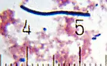 "Lactobacillus delbrueckii" subsp. "bulgaricus" from a sample of yogurt. Numbered ticks are 10 μm apart.