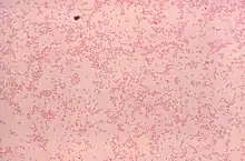 Gram-stained photomicrograph depicting numerous Gram-negative "Brucella canis" bacteria