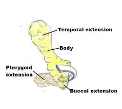 Cheek reduction: Anatomic illustration of the fat pads of the mouth (buccal fat pads).