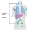 Stage 3 Hodgkin lymphoma