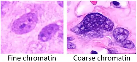 Fine chromatin when inconspicuous (essentially only nucleoli seen in the nuclei), versus coarse chromatin.