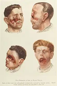 color drawing of mutilated faces.