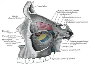 Medial wall of left orbit