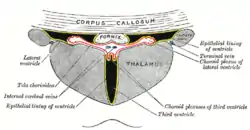 View of ventricles and choroid plexus