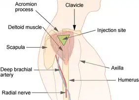 Deltoid site