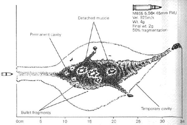 M16A2 M855 5.56×45mm wound ballistics