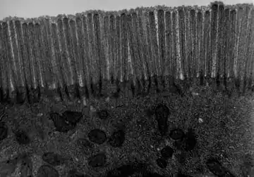 Transmission electron microscope (TEM) image of human jejunum