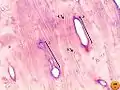 Bone by decalcification (100x): Volkmann's canalHaversian canalLacunaeLamellae