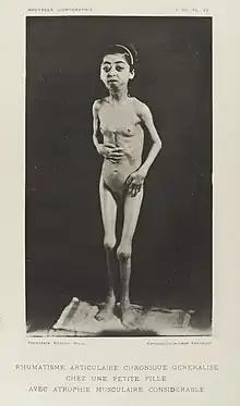 Photograph of patient