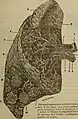 Diagrammatic view of lung showing magnified inner structures including alveolar sacs at 10) and lobules at 9).