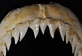 Upper teeth