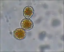 Uredospores