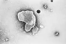 Electron micrograph of RSV