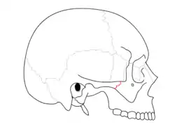 Zygomaticotemporal suture. It separates zygomatic bone and zygomatic process of temporal bone.