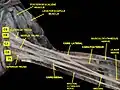 Brachial plexus.Deep dissection. Anterolateral view