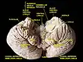 Cerebellum. Inferior surface.