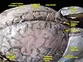 Meninges and superficial cerebral veins. Deep dissection. Superior view.