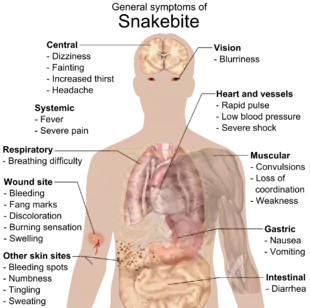 Image 3Most common symptoms of any kind of snake bite envenomation. Furthermore, there is vast variation in symptoms between bites from different types of snakes. (from Snake)