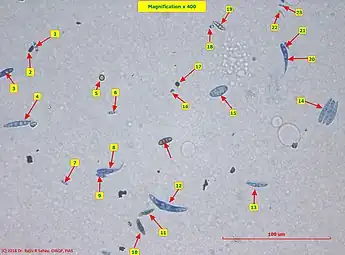 Airborne fungal spores