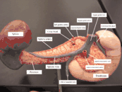 Arteries and veins around the pancreas and spleen