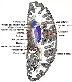 Horizontal section of left cerebral hemisphere.