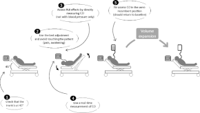 The five key points for a reliable passive leg raising test